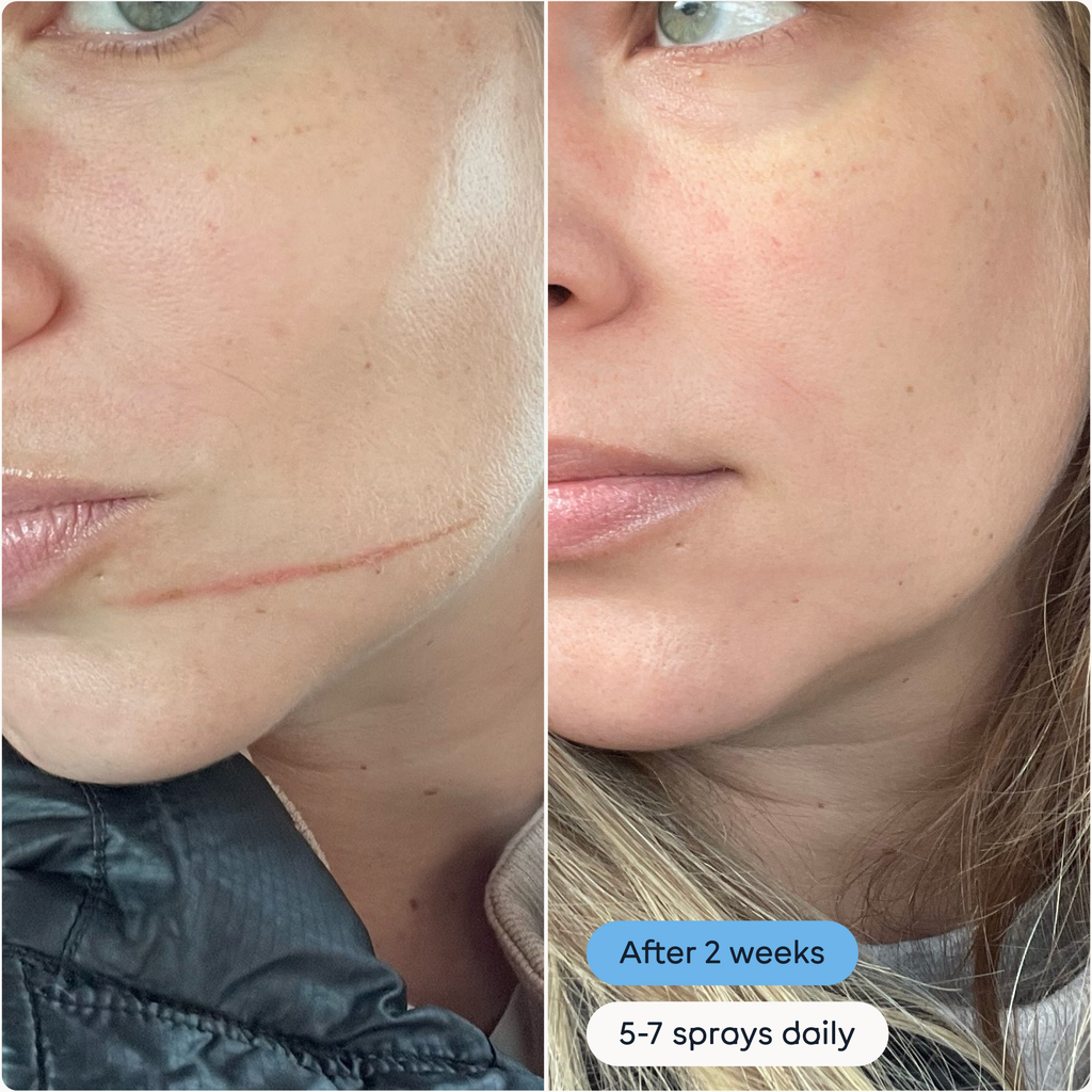 Magic Molecule: The Solution