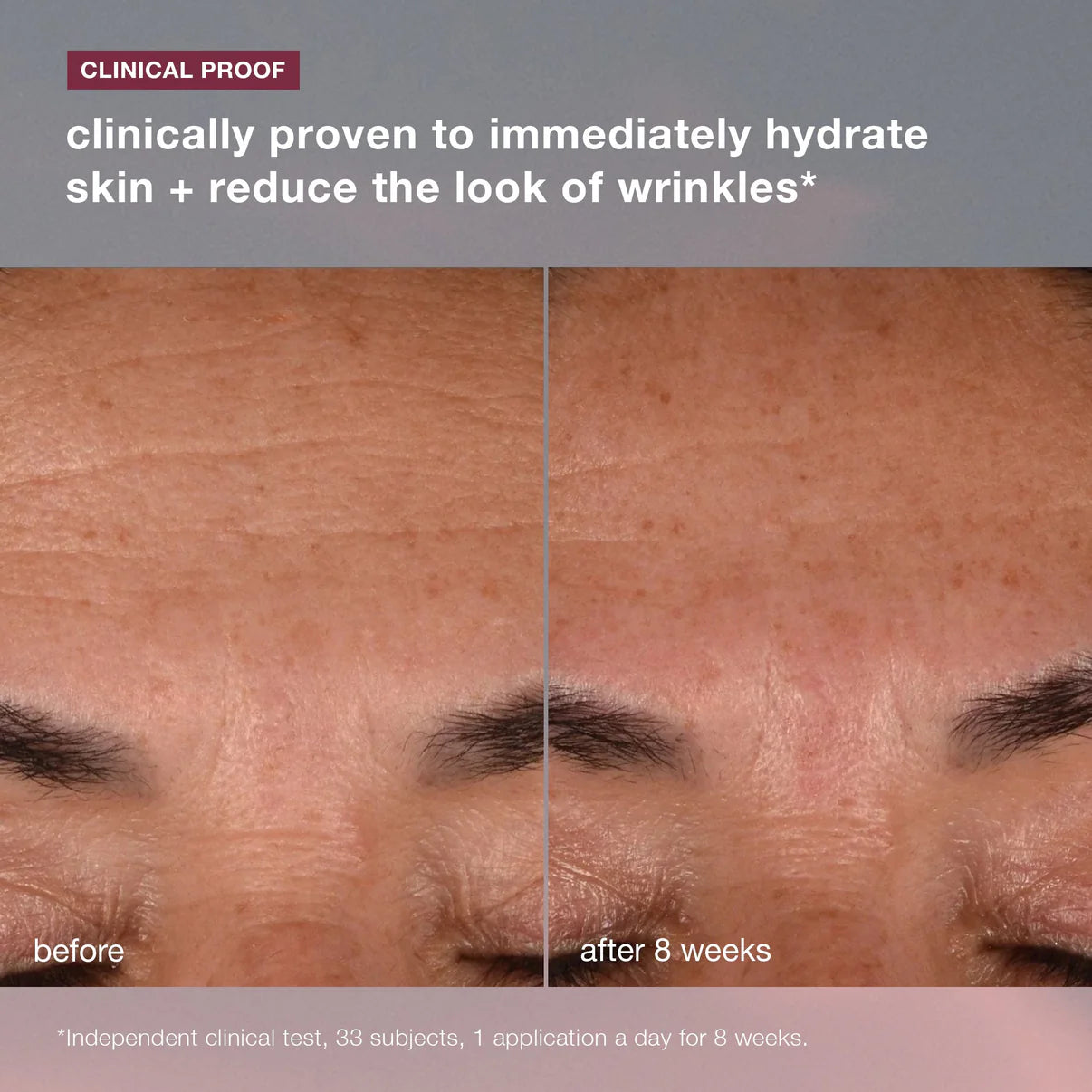 Dermalogica Dynamic Skin Recovery SPF 50 – Age Defense Moisturizer