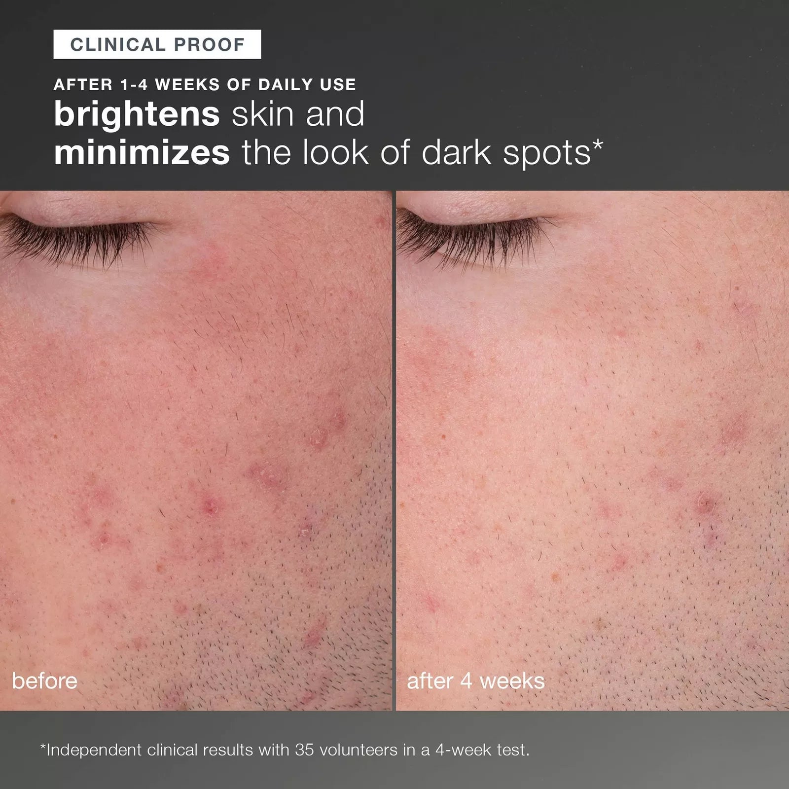 Dermalogica Daily Microfoliant – Gentle Brightening Exfoliating Powder